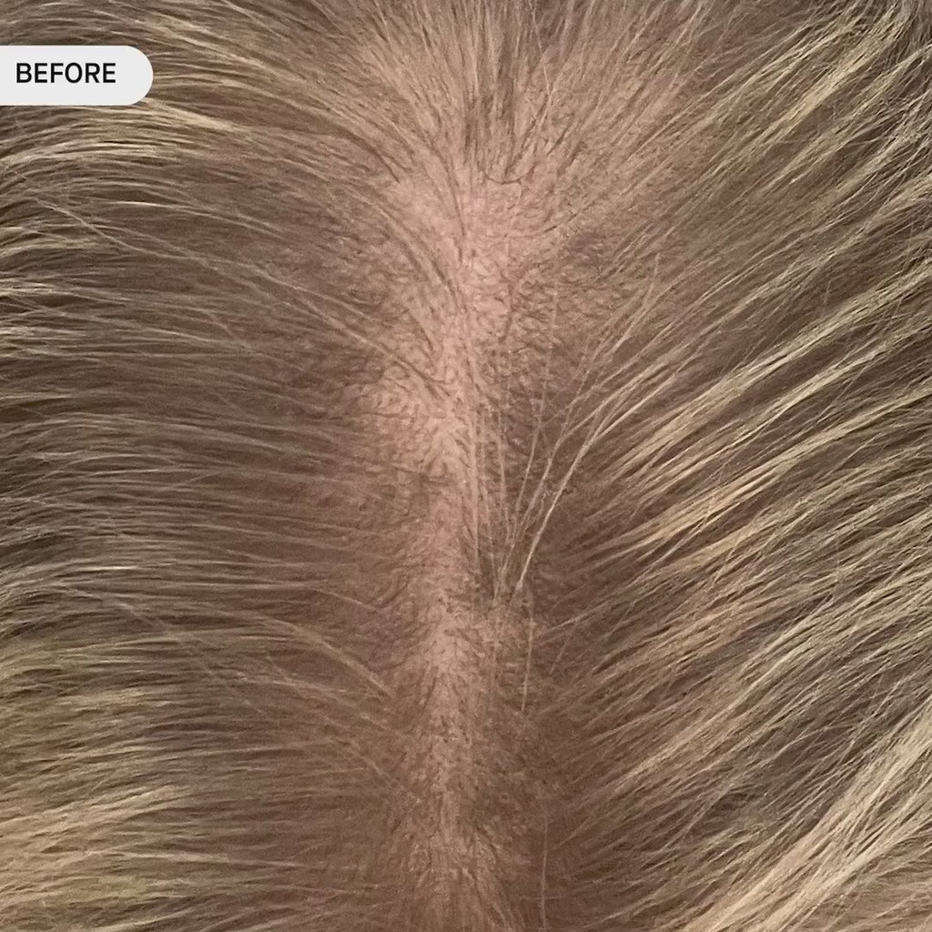 OS-01 HAIR SCALP SERUM