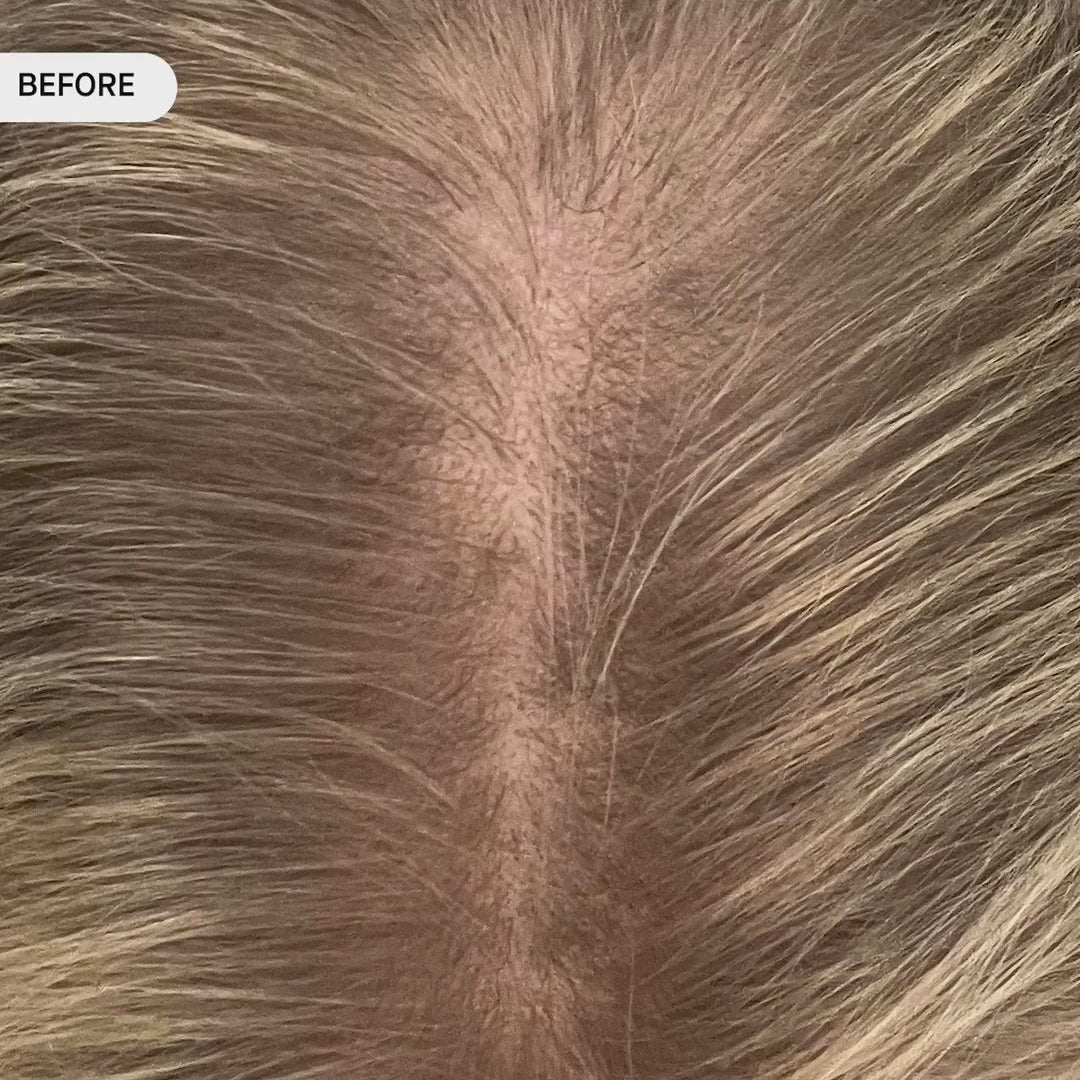 OS-01 HAIR SCALP SERUM